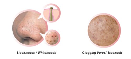 skin problems clogged pores
